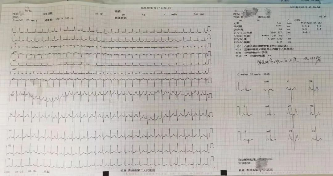 一肖一码一中一特准确资料解释落实的重要性及其实际应用